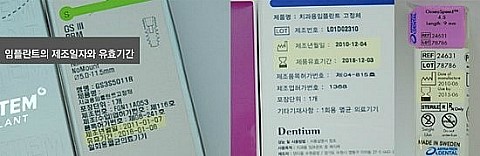 임플란트 가격, 임플란트 가격 비교 관련 이미지 5