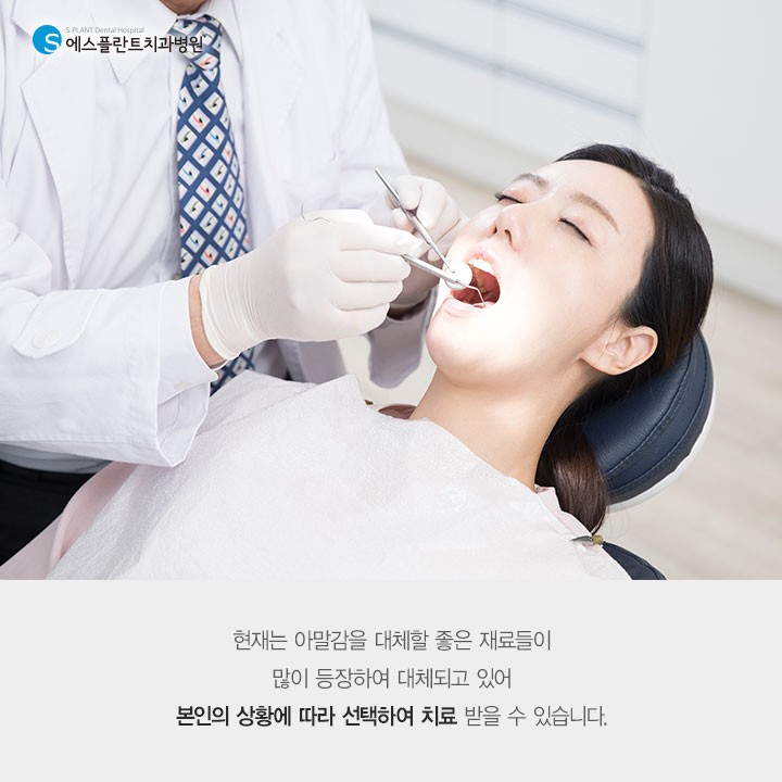 아무도 몰랐던 비밀스러운 [아말감] 관련 이미지 5