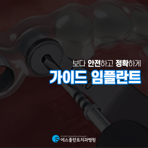 에스플란트 치과병원, 정확한 식립을 위한 가이드 임플란트 관련 이미지 4