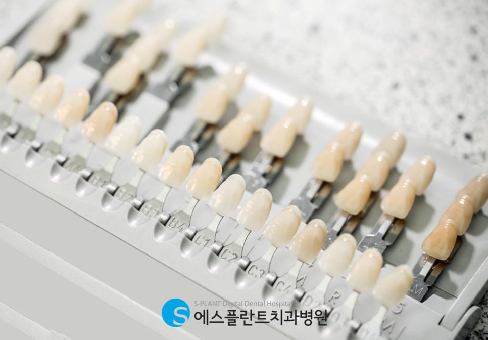Full-Mouth Implants That Restore Lost Teeth: E-Plant Dental Hospital’s Special Solution image 3