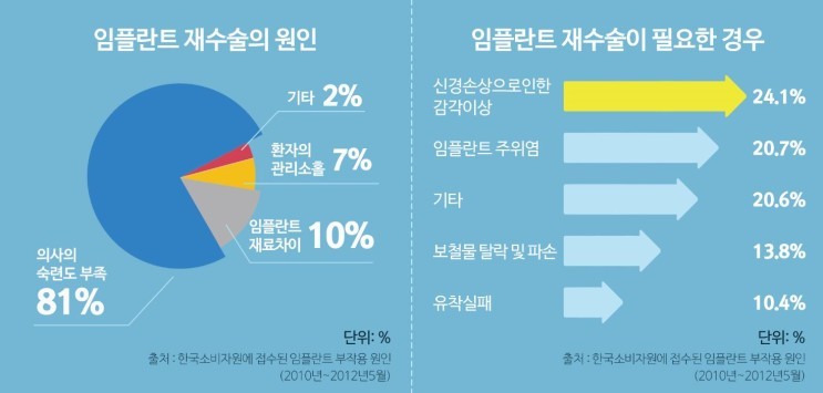 임플란트, 가격차이의 이유를 꼭 알아보세요. 관련 이미지 3