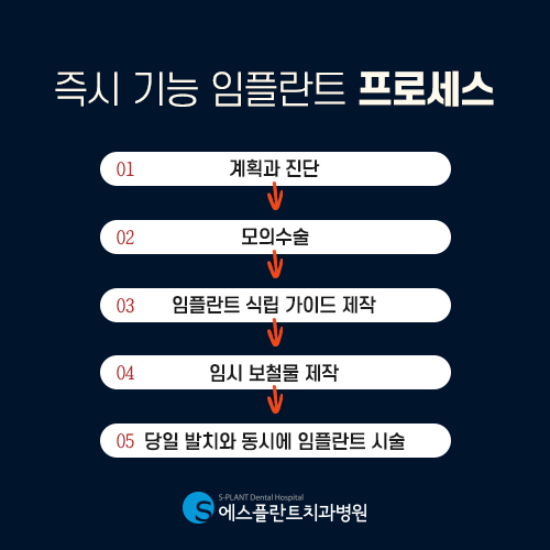 하루만에 발치부터 임시보철물까지 가능한 빠른 치료 [에스플란트 치과병원] 관련 이미지 4