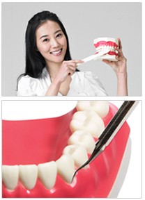 [치과 스케일링] 아프고 비싼 치과치료, 치료보다 중요한 것은 바로 예방 입니다. 관련 이미지 7