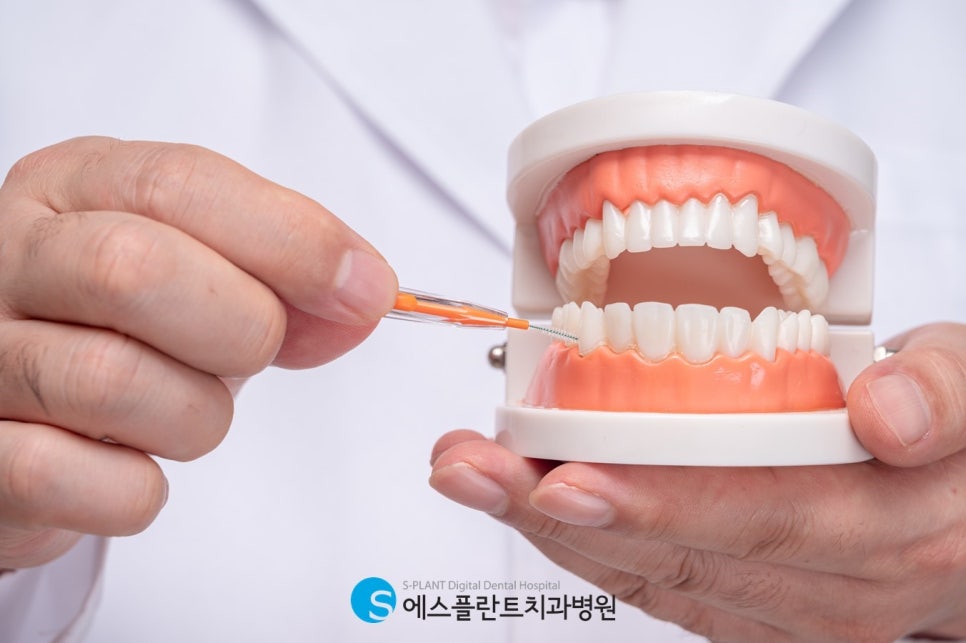 임플란트 사후관리, 체계적인 강남 에스플란트 치과병원과 함께 관련 이미지 1