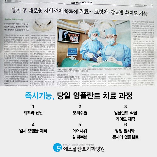 발치 후 바로 임플란트 가능할까요? &ndash; 에스플란트치과병원 관련 이미지 2
