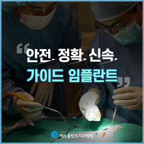 부작용은 줄이고 정확도는 높인 가이드 임플란트 [에스플란트 치과병원] 관련 이미지 4