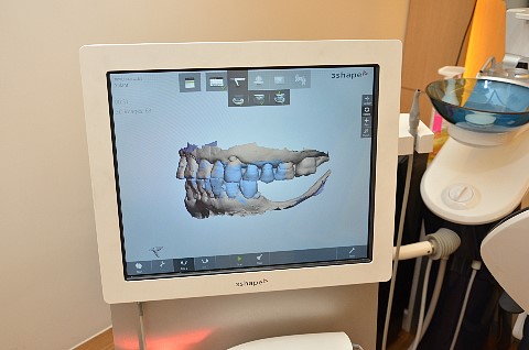 이젠 임플란트도 3D! 관련 이미지 5
