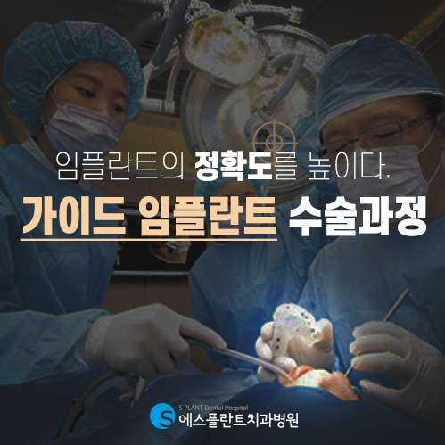 빠르고 정확하고 안전한 에스플란트치과병원의 가이드임플란트 관련 이미지 1