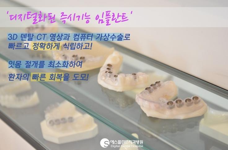 [청담동임플란트]전체임플란트,당일즉시기능임플란트시술과정 관련 이미지 4
