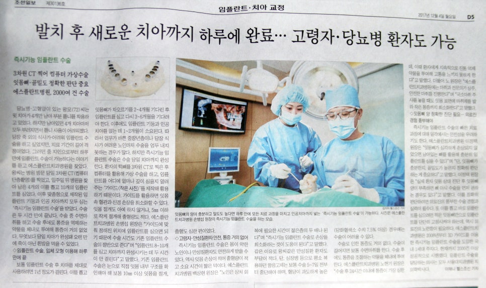 임플란트 당뇨 환자도 가능할까요? – 에스플란트치과병원 관련 이미지 8