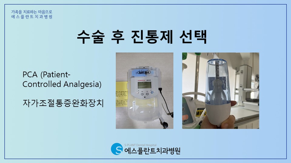 임플란트 식립 후 통증을 조절하는 방법 [에스플란트 치과병원] 관련 이미지 5
