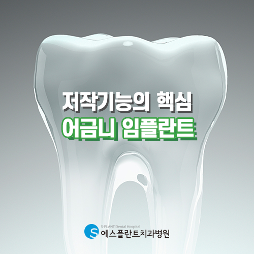어금니 임플란트, 치아 건강과 미적 면에서 완벽한 선택 관련 이미지 1
