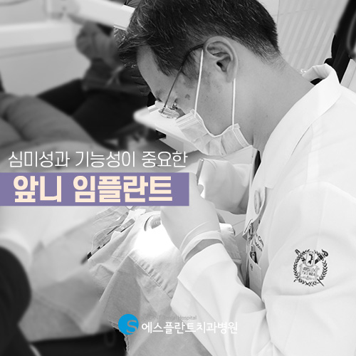 까다로운 앞니 임플란트도 에스플란트 치과병원에서는 문제 없습니다. 관련 이미지 4