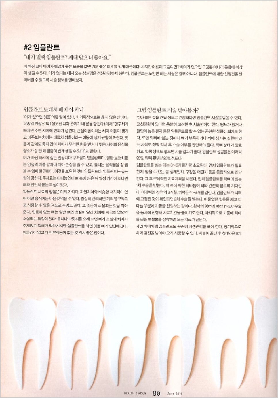 [에스플란트치과병원] 헬스조선 건강의 시작, 건치 프로젝트2 관련 이미지 2