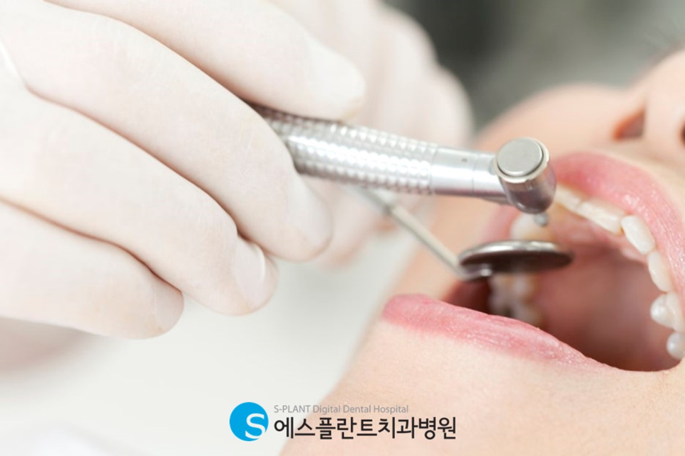 Gangnam Implant Dental Clinic: How Can Molar Implants Restore Chewing Function?! image 2