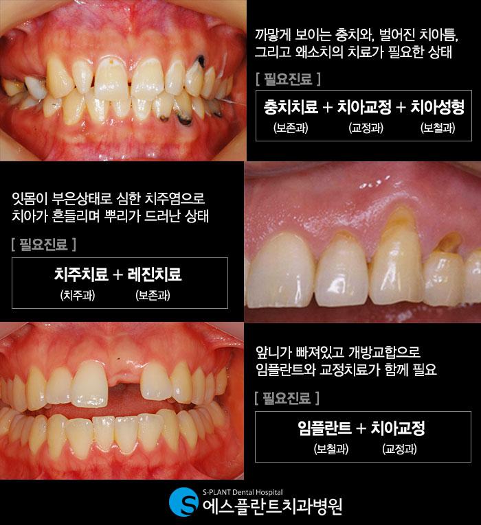 치과에서분과별진료와협진진료는정말중요합니다. 관련 이미지 2