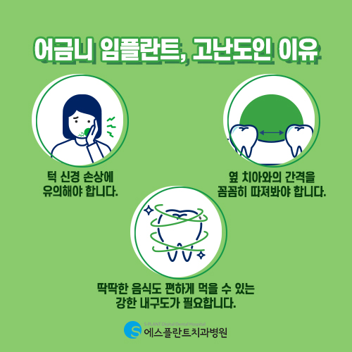 저작력 회복, 높은 강도가 중요한 어금니 임플란트 [에스플란트 치과병원] 관련 이미지 3