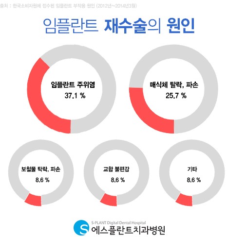 심각하면 재수술까지 이어지는 임플란트 주위염 예방방법은? 관련 이미지 2