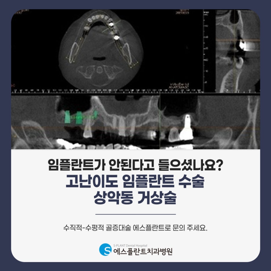 강남오스템임플란트, 수술 후 관리법 총정리 관련 이미지 6