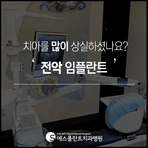 한 번에 여러 개 식립도 문제없는 에스플란트 치과병원의 전악 임플란트 관련 이미지 3