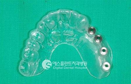 똑똑한 관련 이미지 7