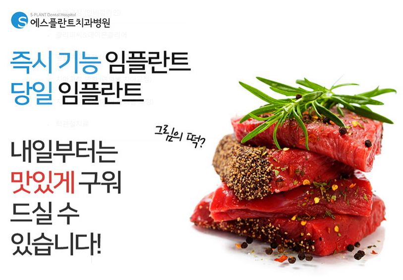 하루만에 발치부터 임시보철물 까지 가능한 에스플란트 치과병원의 빠른 치료 관련 이미지 2