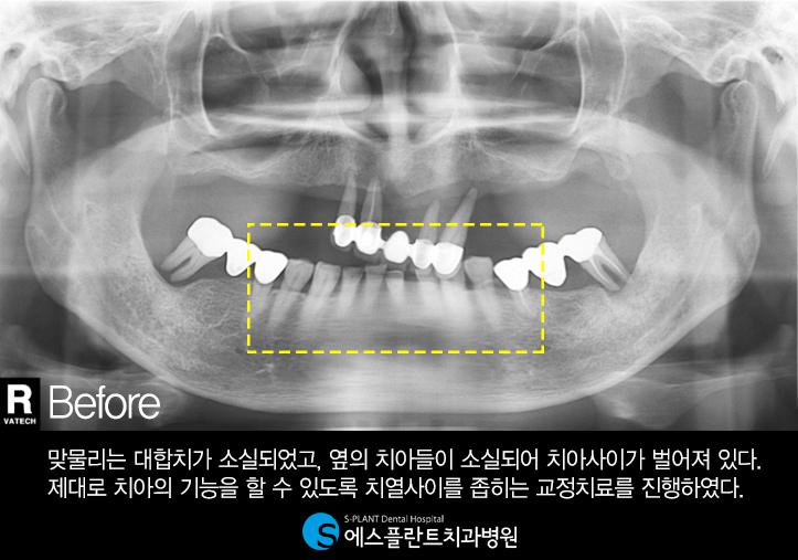 치과에서분과별진료와협진진료는정말중요합니다. 관련 이미지 3