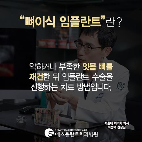 뼈이식임플란트 성공적인 임플란트의 지름길 – 에스플란트치과병원 관련 이미지 3