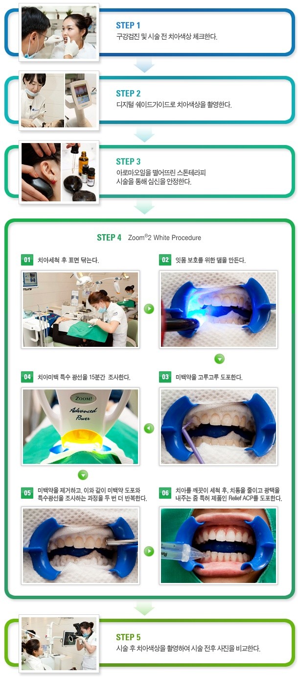 예비신부, 치아미백으로 자신있게 웃자! 관련 이미지 3