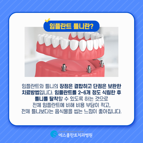 임플란트와 틀니를 고민하고 있다면 임플란트틀니는 어떨까요? 관련 이미지 5