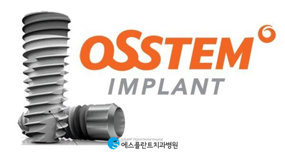 If You're Considering Gangnam Osstem Implant?! At S-Plant Dental Hospital image 2