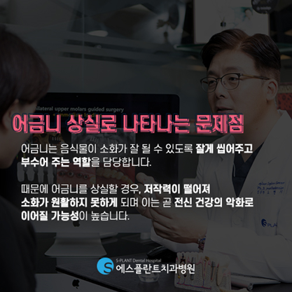 먹는 즐거움을 위한 어금니 임플란트를 소개합니다! 관련 이미지 1