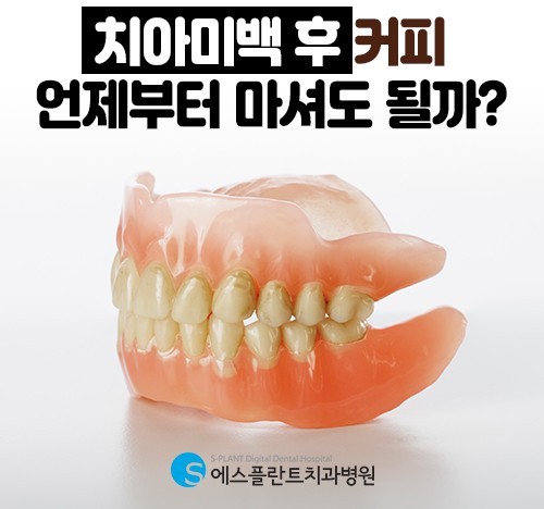 치아미백후커피 언제부터 마셔도 될까요? 치아를 변색시키는 음식 5가지 관련 이미지 1