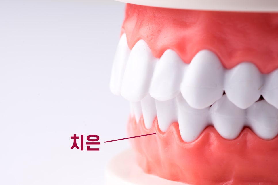 치아의 구조를 알아보자 [에스플란트 치과병원] 관련 이미지 7
