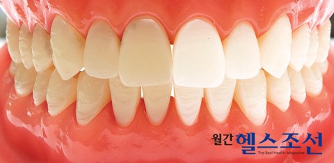 [미백치약] 미백치약, 희고 깨끗한 치아의 꿈 치약으로 가능할까? 관련 이미지 2