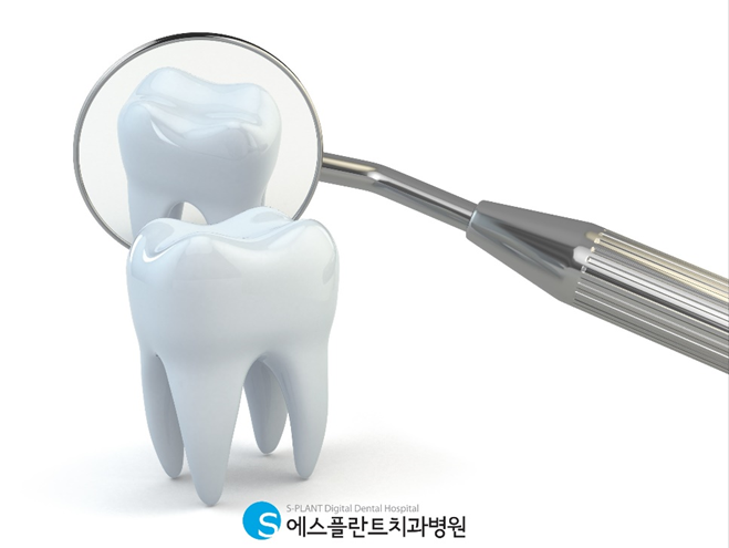 전악임플란트로 치아 기능을 회복하세요! <전악임플란트 치료사례> 관련 이미지 6