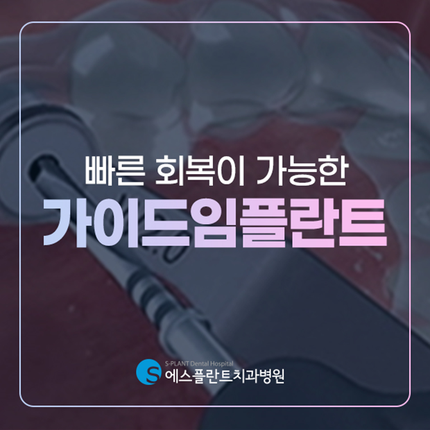 통증과 회복이 걱정이라면? 가이드임플란트 하세요. 관련 이미지 1