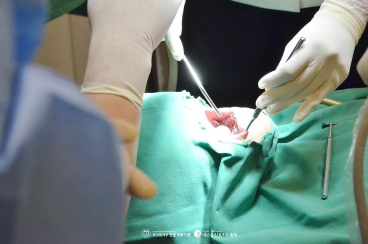 [임플란트건강보험적용]에스플란트치과병원에서임플란트시술로드 시는즐거움도되찾으세요! 관련 이미지 3