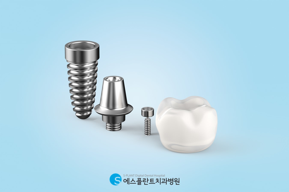 청담동 임플란트 뼈이식, 에스플란트치과병원에서 관련 이미지 3