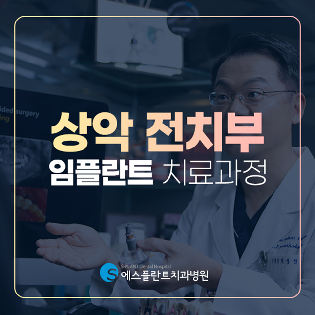 상악 전치부 임플란트로 심미성을 회복하세요. 관련 이미지 1