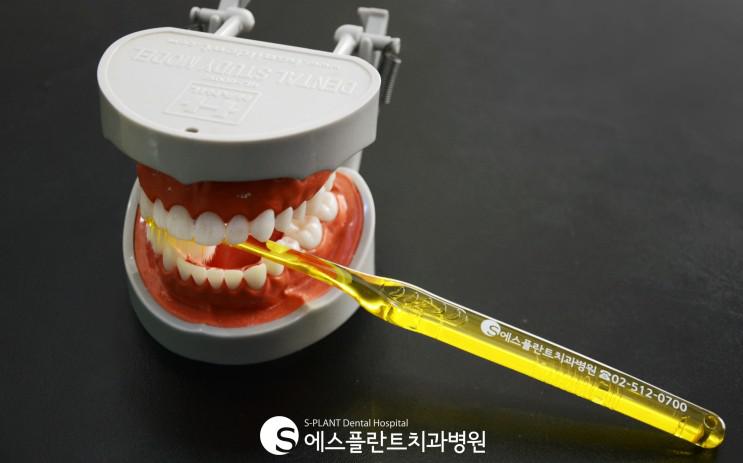 에스플란트치과병원 임플란트오래쓰는법 관련 이미지 5