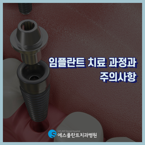 성공적인 임플란트를 위한 임플란트 식립 후 주의사항 [에스플란트 치과병원] 관련 이미지 3