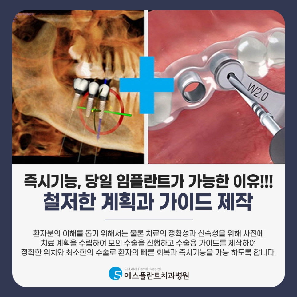 A Gangnam dental clinic known for implants: Understanding implant costs accurately, explained by S-Plant Dental Hospital image 4