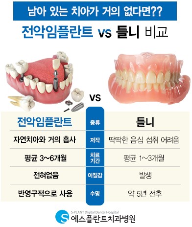 전악임플란트, 새로운 삶 얻어. – 에스플란트치과병원 관련 이미지 3