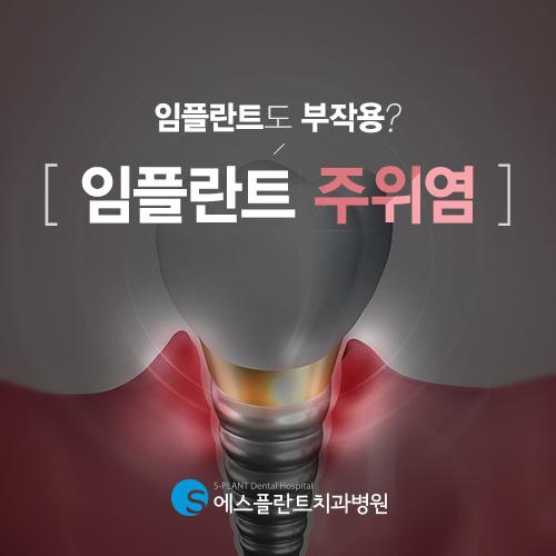 임플란트도 염증이? 임플란트 주위염이란 관련 이미지 1