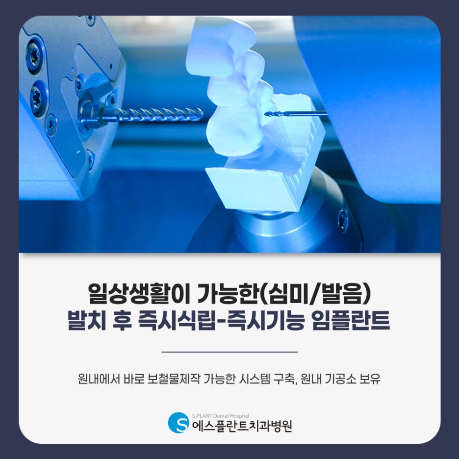 Apgujeong Rodeo Dental Implants in Your 20s: The Key to Protecting Your Dental Health! image 5