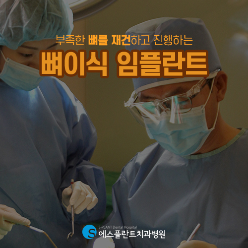 임플란트, 잇몸뼈가 부족하거나 약한 경우에는 어떻게 진행될까 [에스플란트 치과병원] 관련 이미지 3