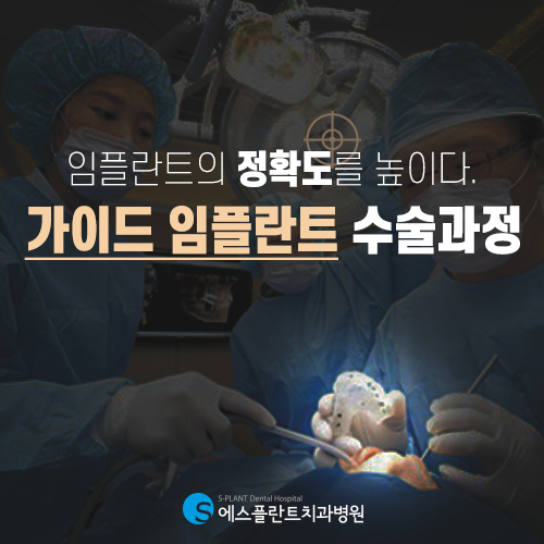 보다 안전하고 정확하게, 압구정 에스플란트 치과병원의 가이드 임플란트 관련 이미지 1