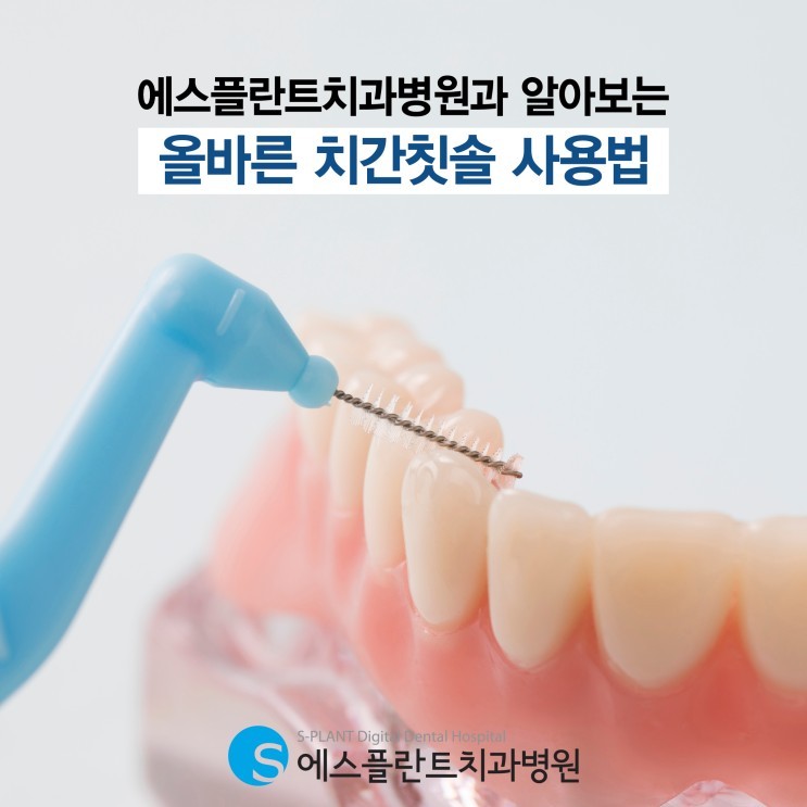 에스플란트치과병원과 알아보는 올바른 치간칫솔 사용법 관련 이미지 1