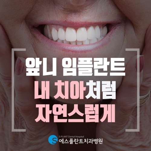 앞니 임플란트 내 치아처럼 자연스럽게 관련 이미지 1